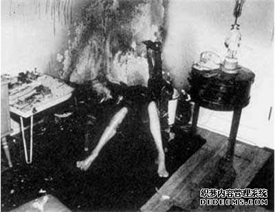 人體自燃之謎:人體自燃是真的嗎 如何才會產(chǎn)生自燃現(xiàn)象