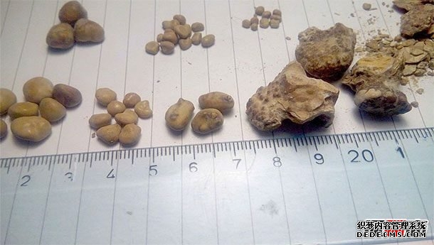人生最痛苦的事情莫過于?世界上十大最痛苦的事情