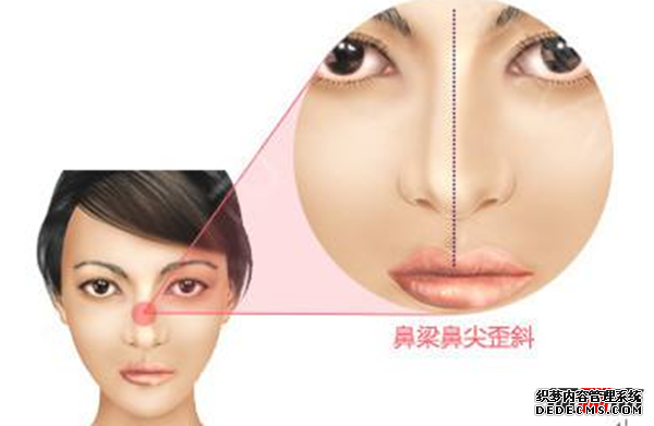 人快死的時候是什么感覺?人快死的時候15個征兆