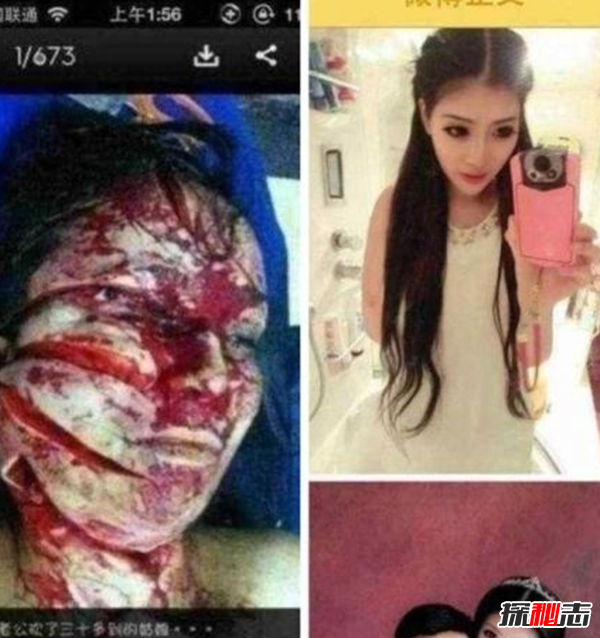 南京富二代殺妻真相,用刀4把傷口多達(dá)60多處(附照片)