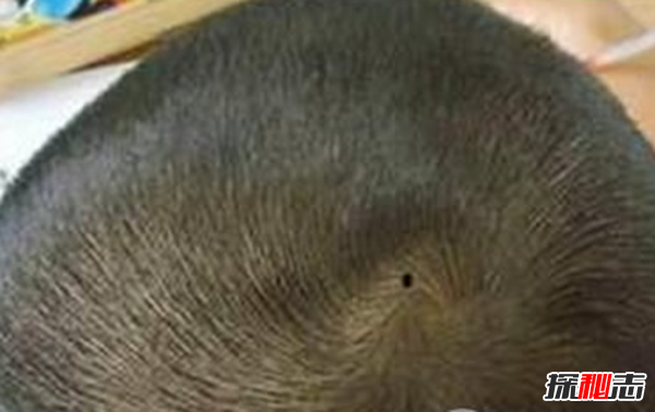 男人哪里長痣最有福氣,男人10處有痣是富貴痣